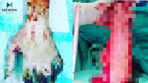 کچێکی سنەیی لەبەر ئەوەی خۆشەویستی هەبوو باوکی سوتاندی
