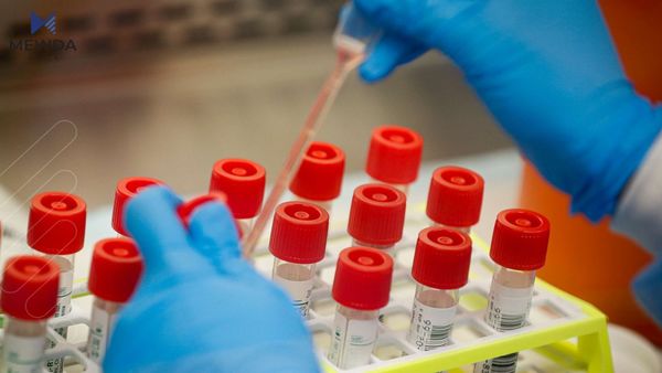 ئامارەکانی تووشبوون بە کۆرۆنا لە هەرێمی کوردستان لە کەمیکردووە