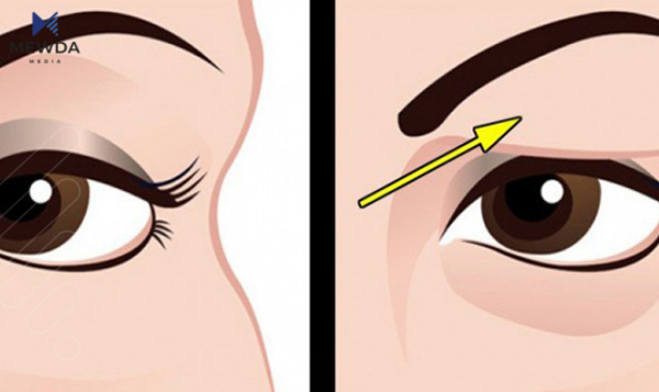 نەشتەرگەری پێڵوی چاو و چۆنیەتی ئەنجامدانی